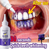 V34 Purple Toothpaste Teeth Whitening Enzyme Remove Plaque Stains Oral Hygiene Cleaning Dental Tools Fresh Breath Beauty Health