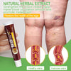 1Pcs Varicose Veins Treatment Cream Remove Red Blood Streaks Varicocele Vasculitis Phlebitis Strengthen Capillary Health S034