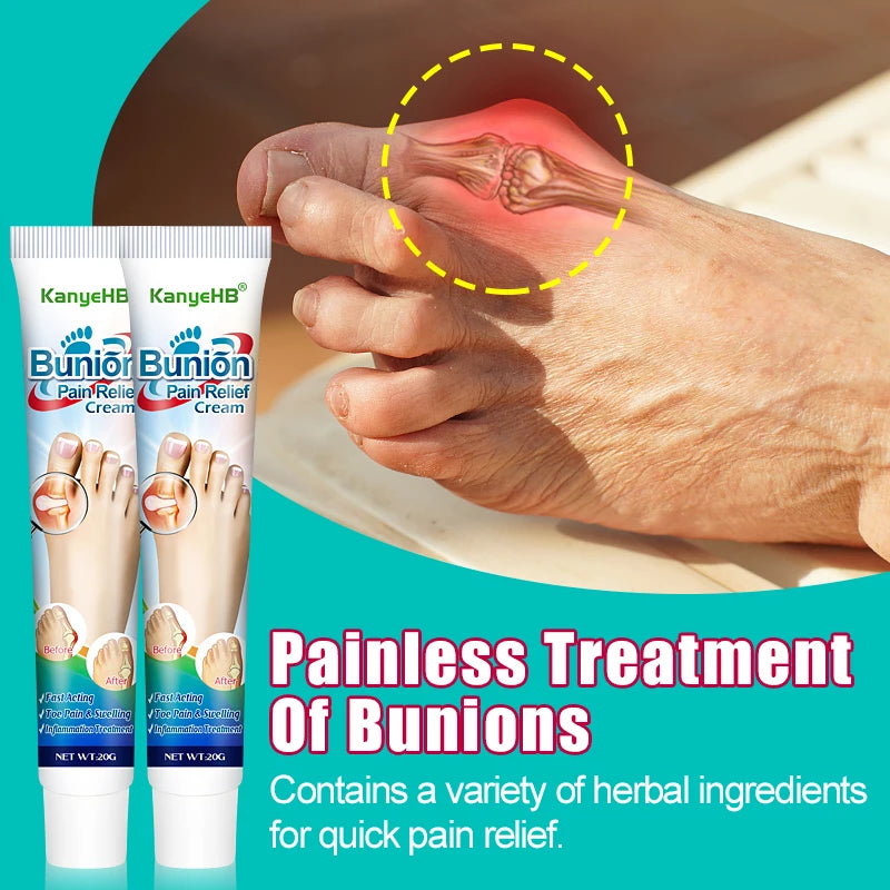 1Pcs Foot Gout Treatment Cream Thumb Corrector Finger Hallux Ointment Toe Bunion Pain Relieve Medical Plaster Health Care G019