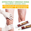 1Pcs Varicose Veins Treatment Cream Remove Red Blood Streaks Varicocele Vasculitis Phlebitis Strengthen Capillary Health S034